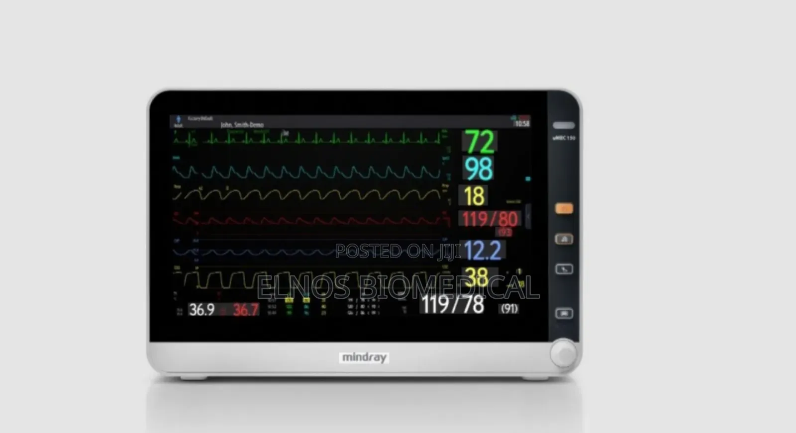Mindray Umec 150 Patient Monitor (15.6” Icu Multiparameter Monitor)