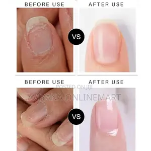 Lanthome Nail Repair