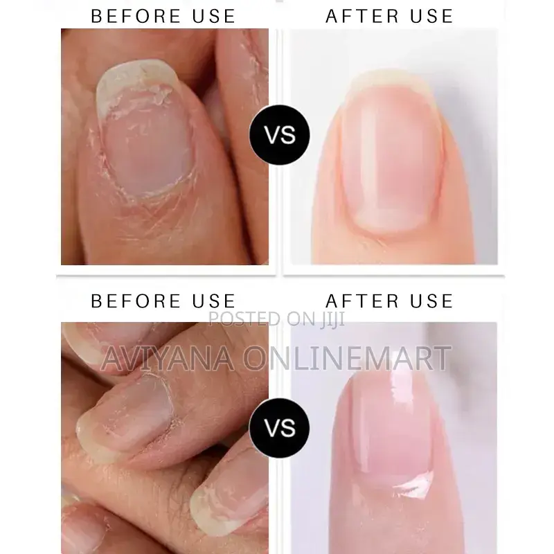 Lanthome Nail Repair
