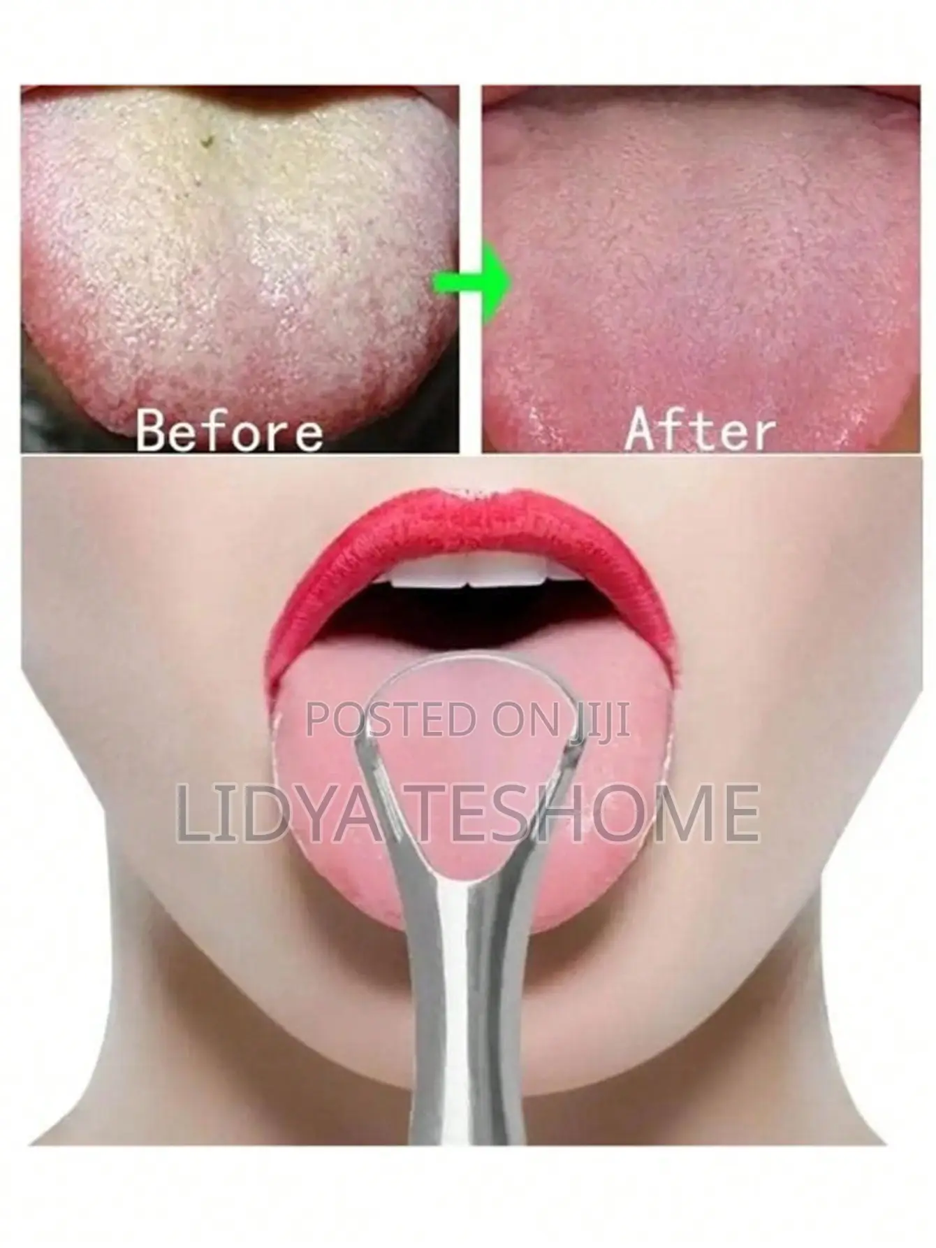 Tongue Scraper የምላስ ማፅጃ