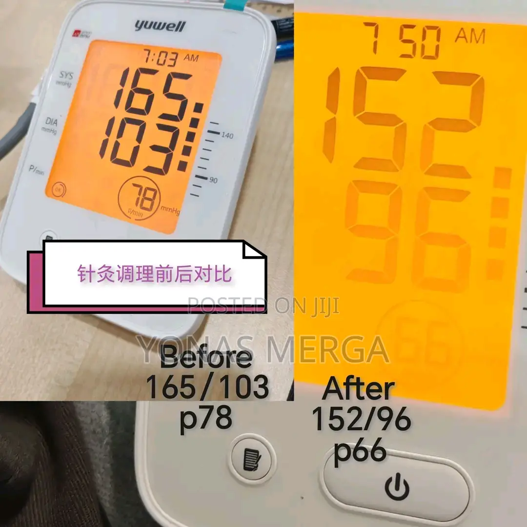Blood Pressure Monitor怜户durable Air Chamber, Pump and Control