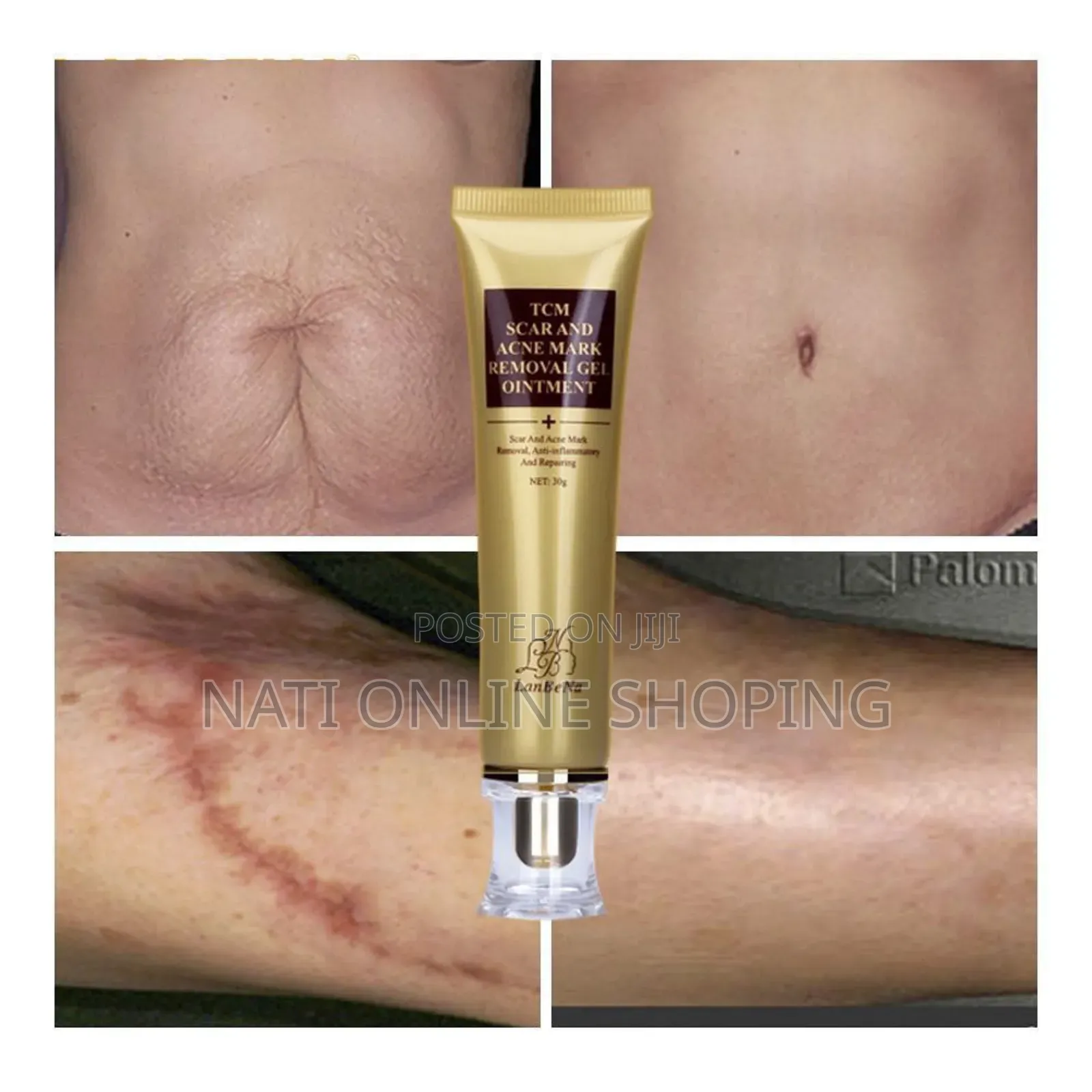 Scar Removal
