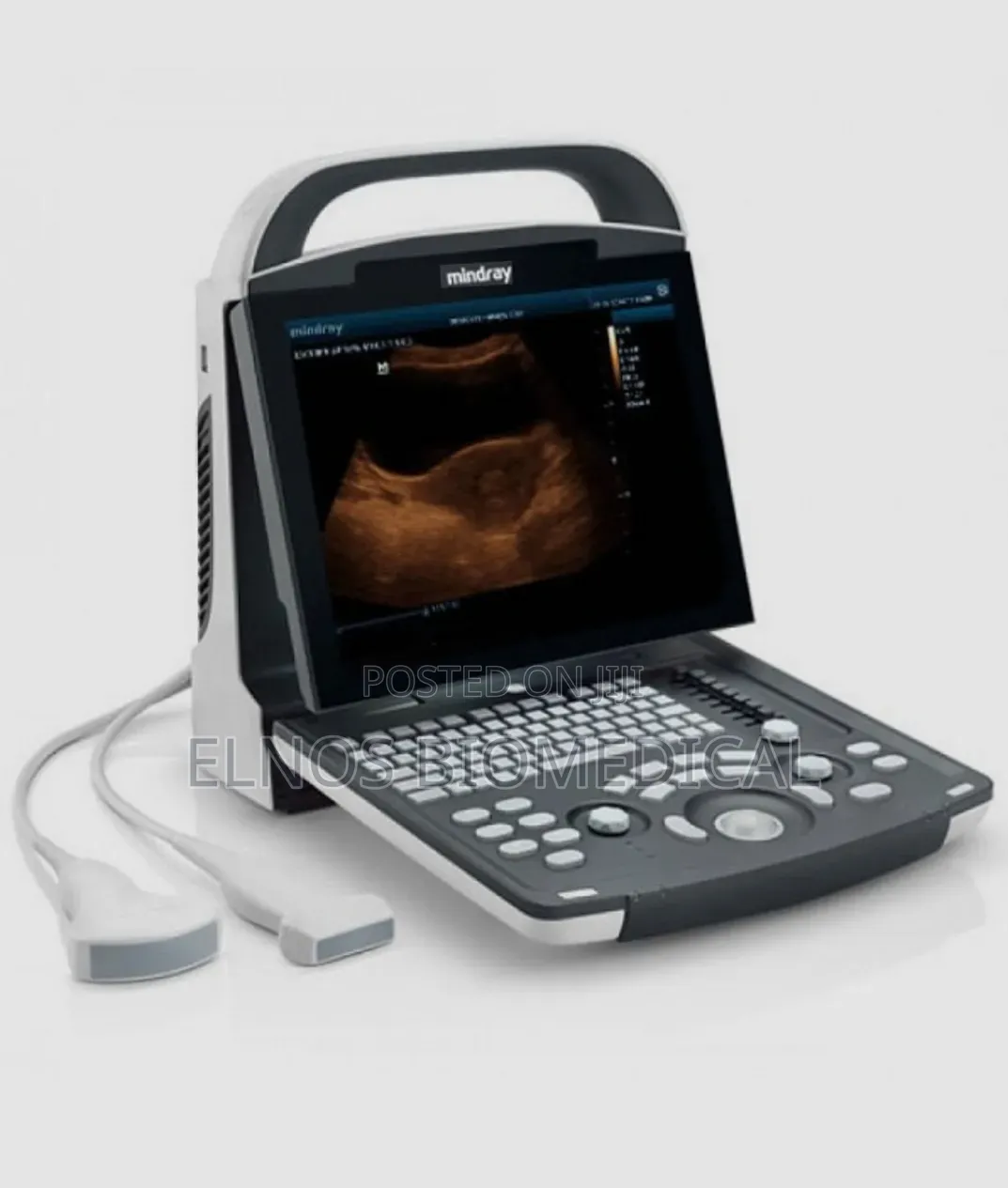 Mindray Dp-10 Digital Portable Ultrasound Machine