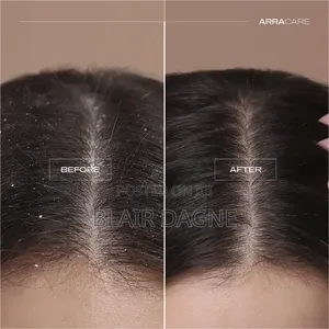 Nizoral Anti-Dandruff Shampoo