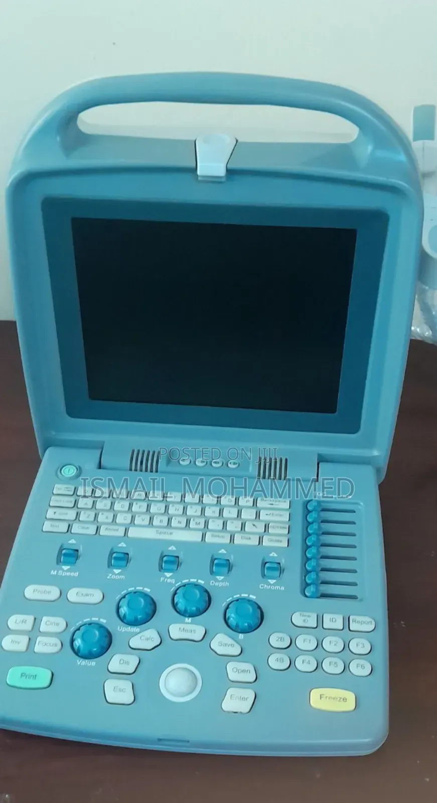 Slightly Used Siui CTS 5500 Ultrasound Machine