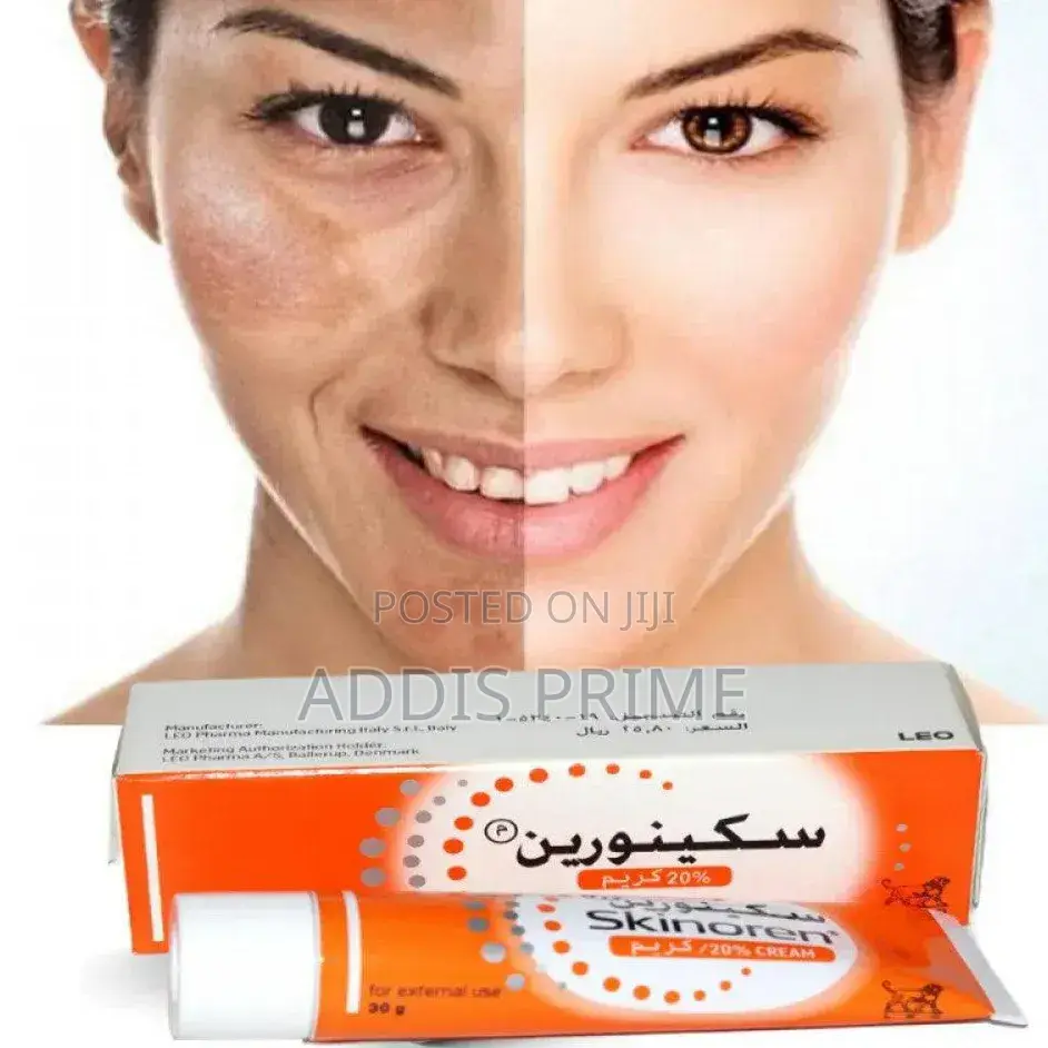 Skinoren 20% Azelaic Acid Cream – Acne Dark Spot Treatment (30g)