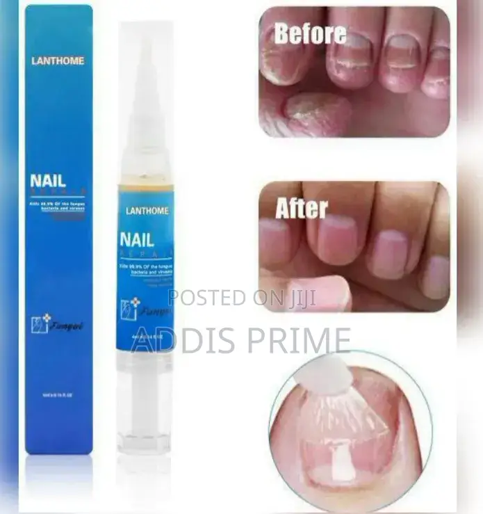 Lanthome Nail Repair : የጥፋር ፈንገስ ማጥፊያ እና ጥፋር ማስተካከያ