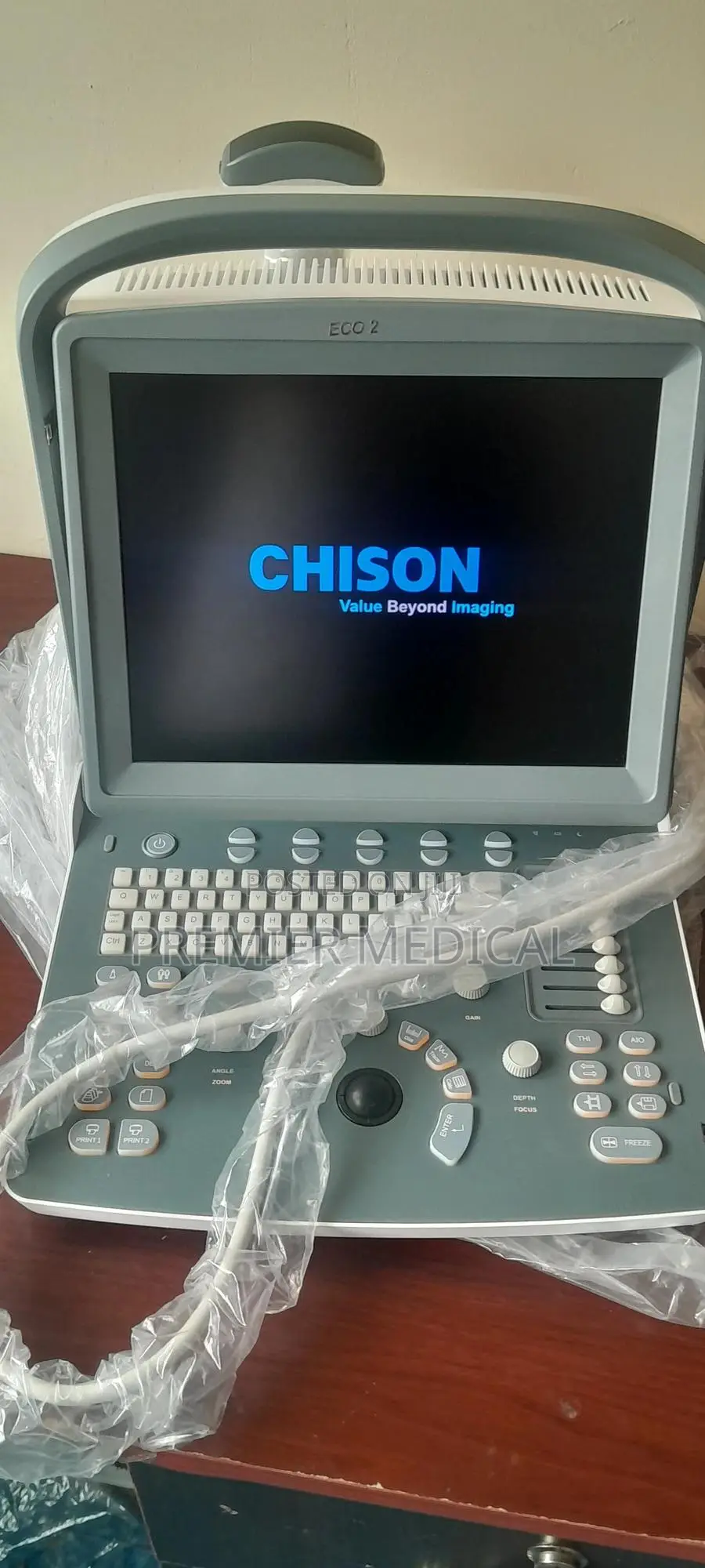 Chison Eco 2 Ultrasound Machine