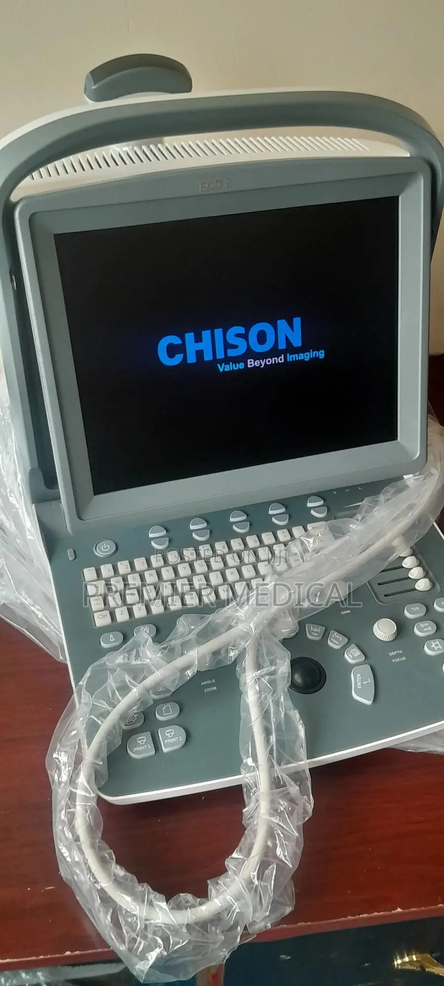 Chison Eco 2 Ultrasound Machine