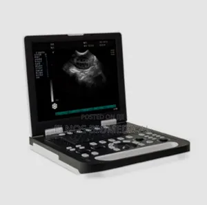 New Sonostar Ultrasound