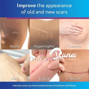 Scaraway Silicone Scar Gel