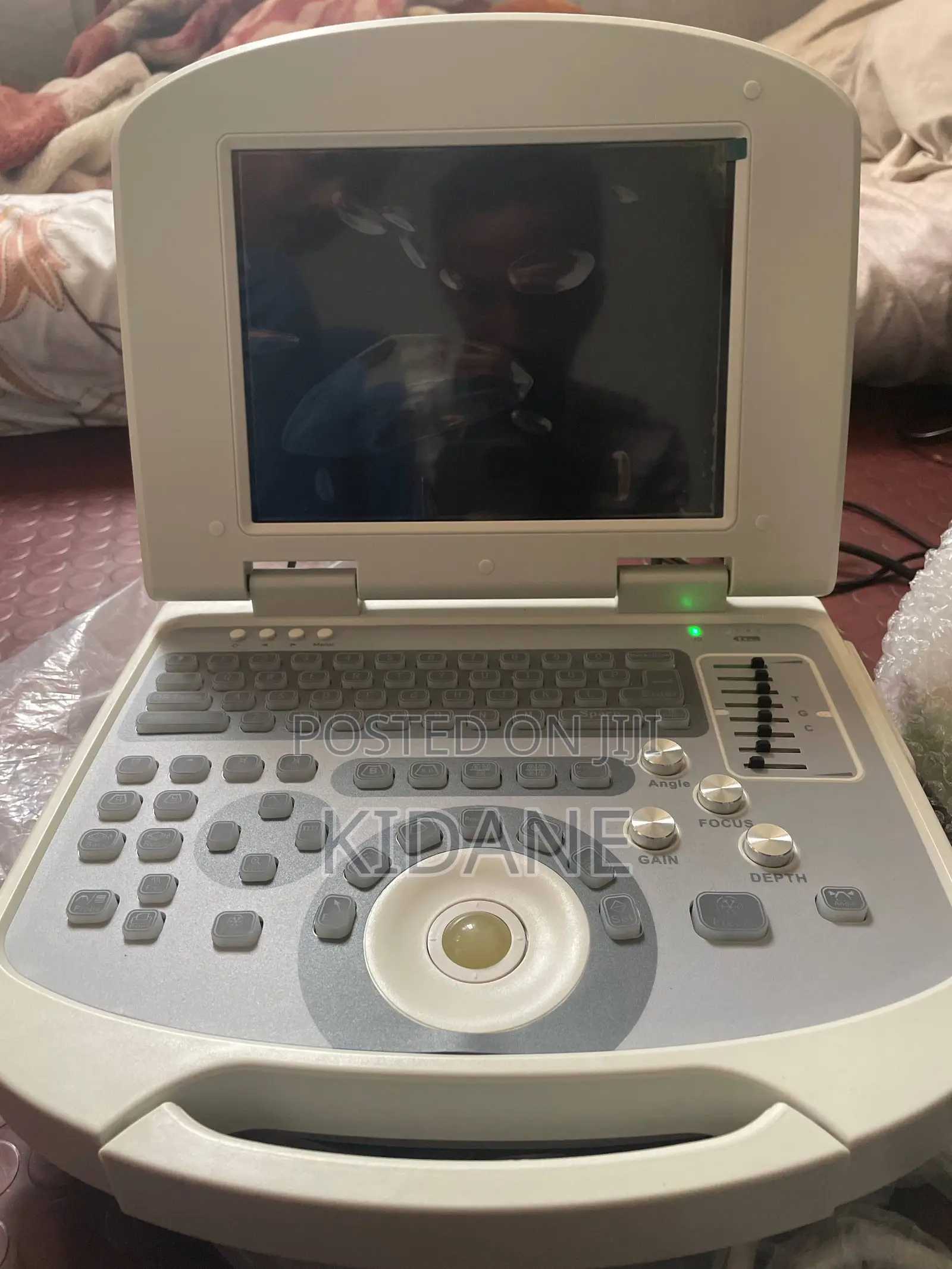 Portable Digital Ultrasound Scanner