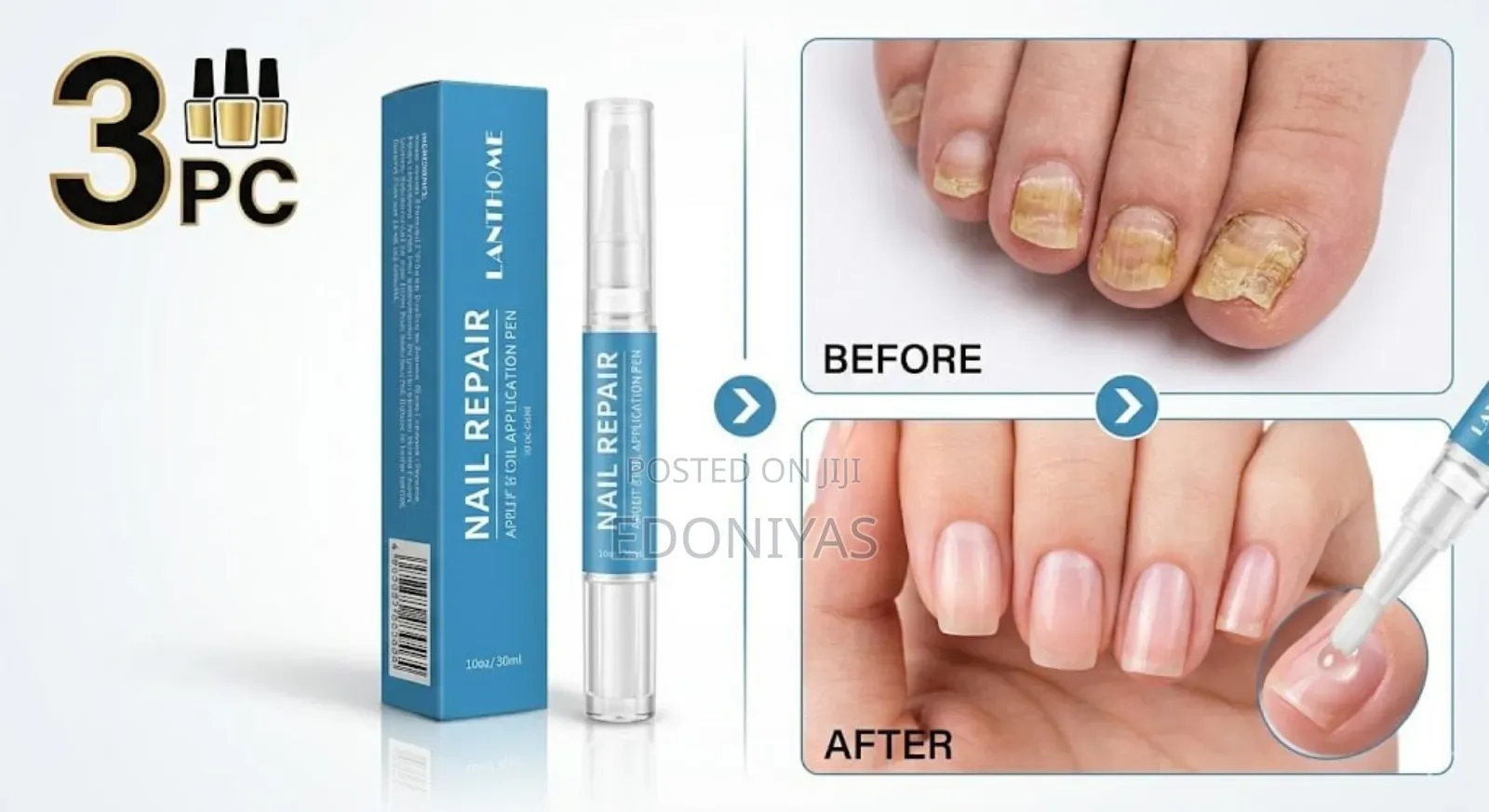 Lanthome Nail Repair