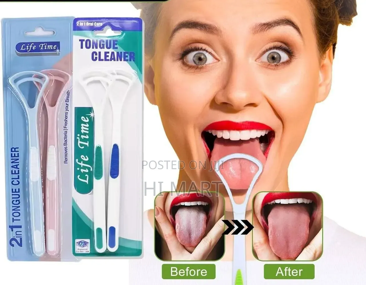 2pcs High Quality Modern Tongue Cleaner