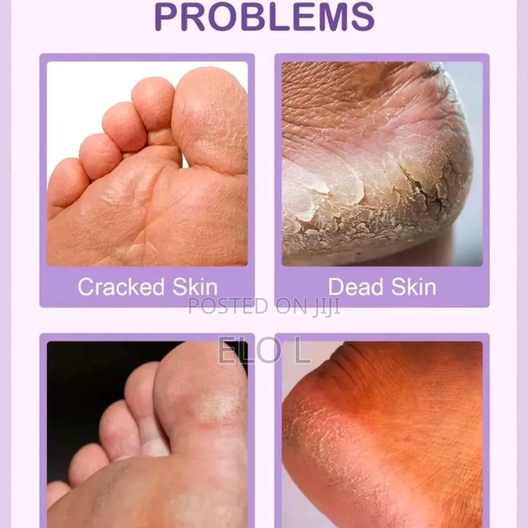 Foot Cream