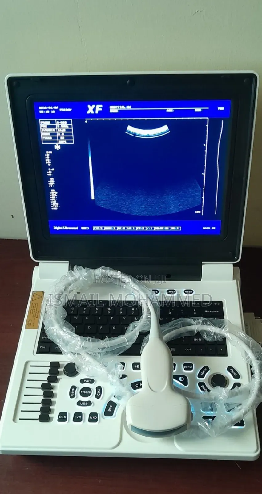 Slightly Used Xf-30 Ultrasound Machine