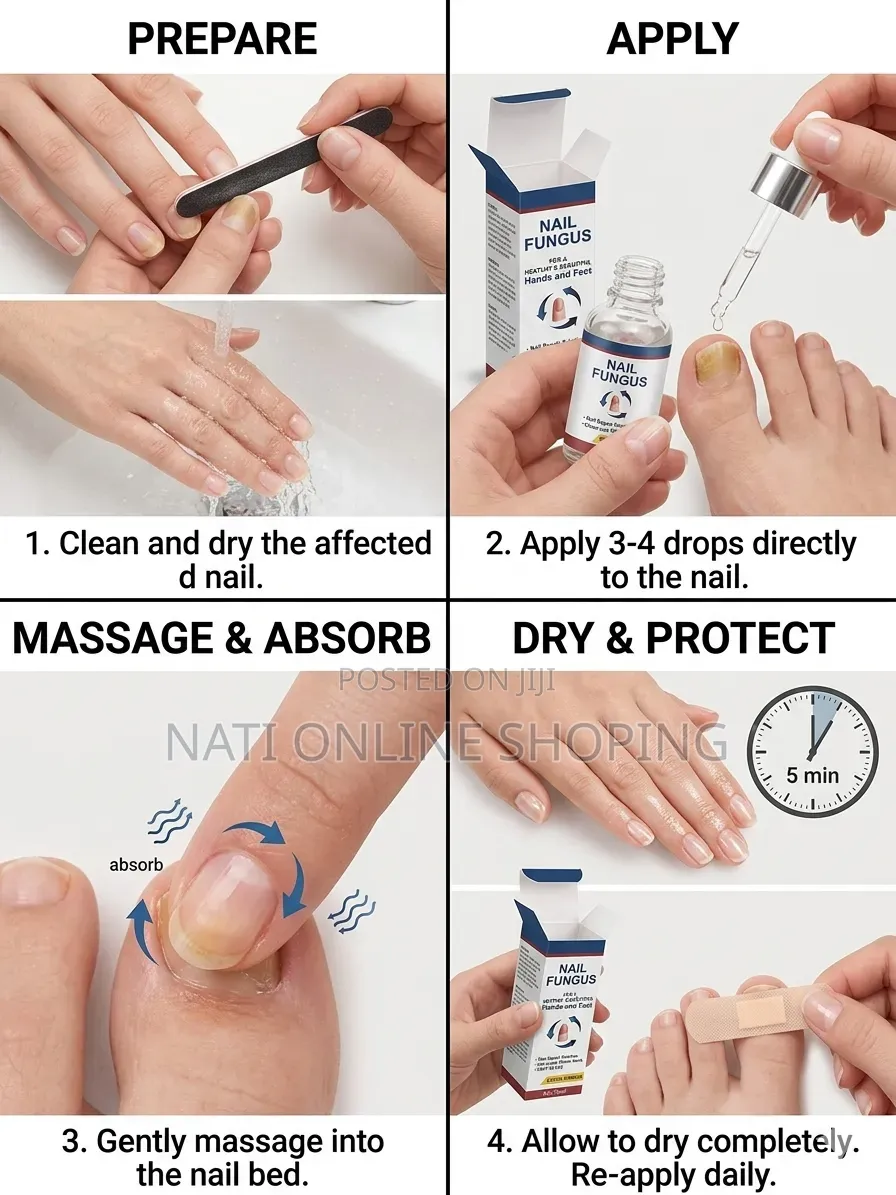 Nail Fungus Repairs