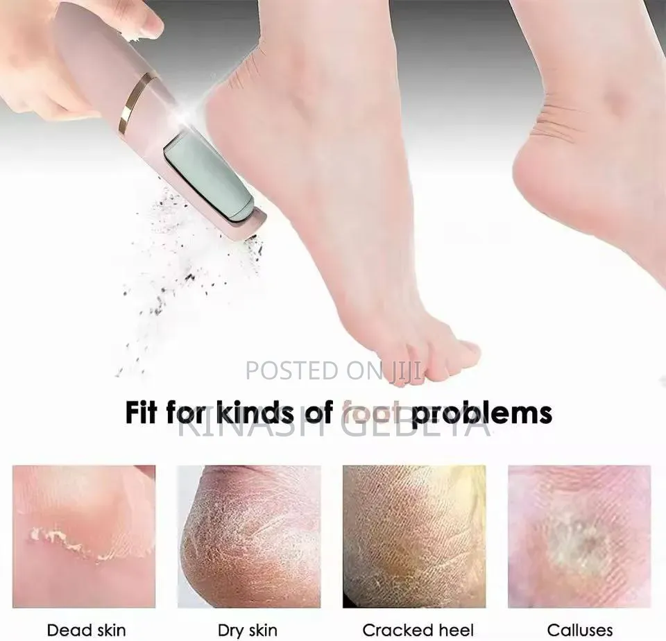 Electric Pedi Callous Remover