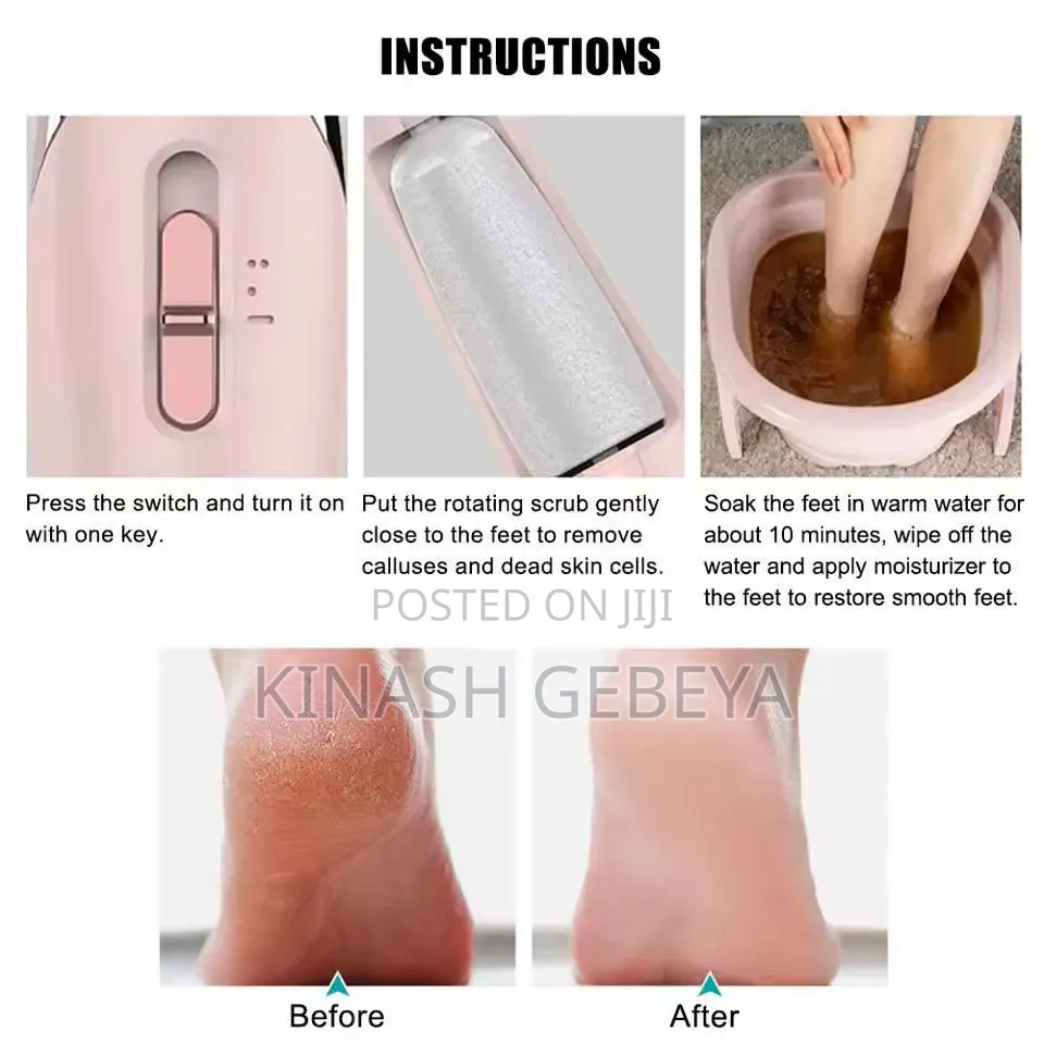 Electric Pedi Callous Remover