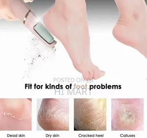 2 Head Electric Pedi Callous Remover