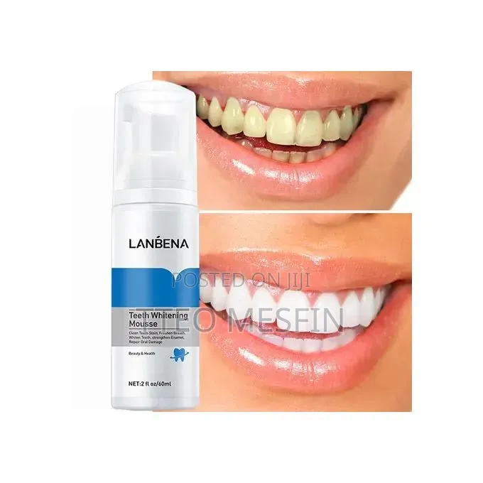 Lanbena , የጥርስ ሳሙና, የጥርስ ማንጫ
