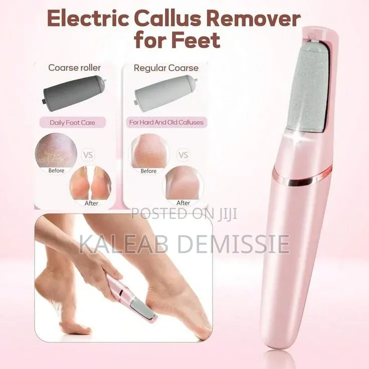 Electric Pedi Callous Remover