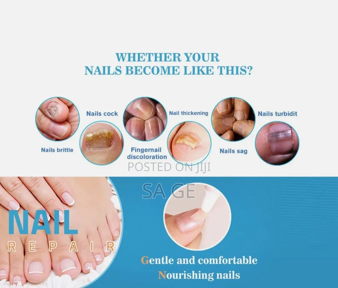 Lanthome Nail Repair