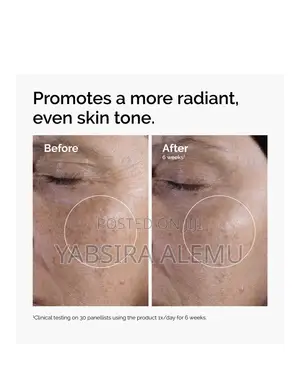 Glycolic Acids