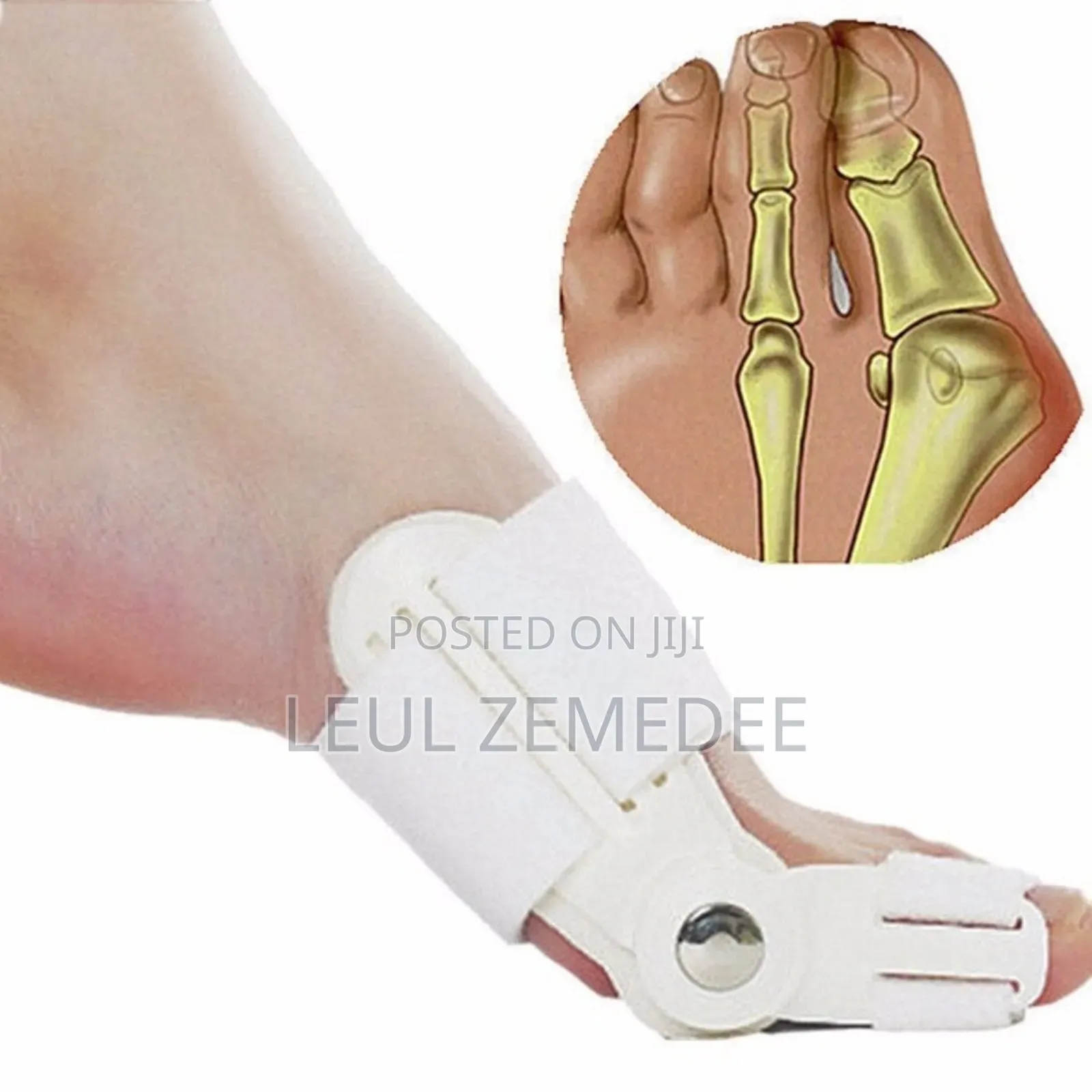 የእግር አውራ ጣት ማስተካከያ | Leg Straightner
