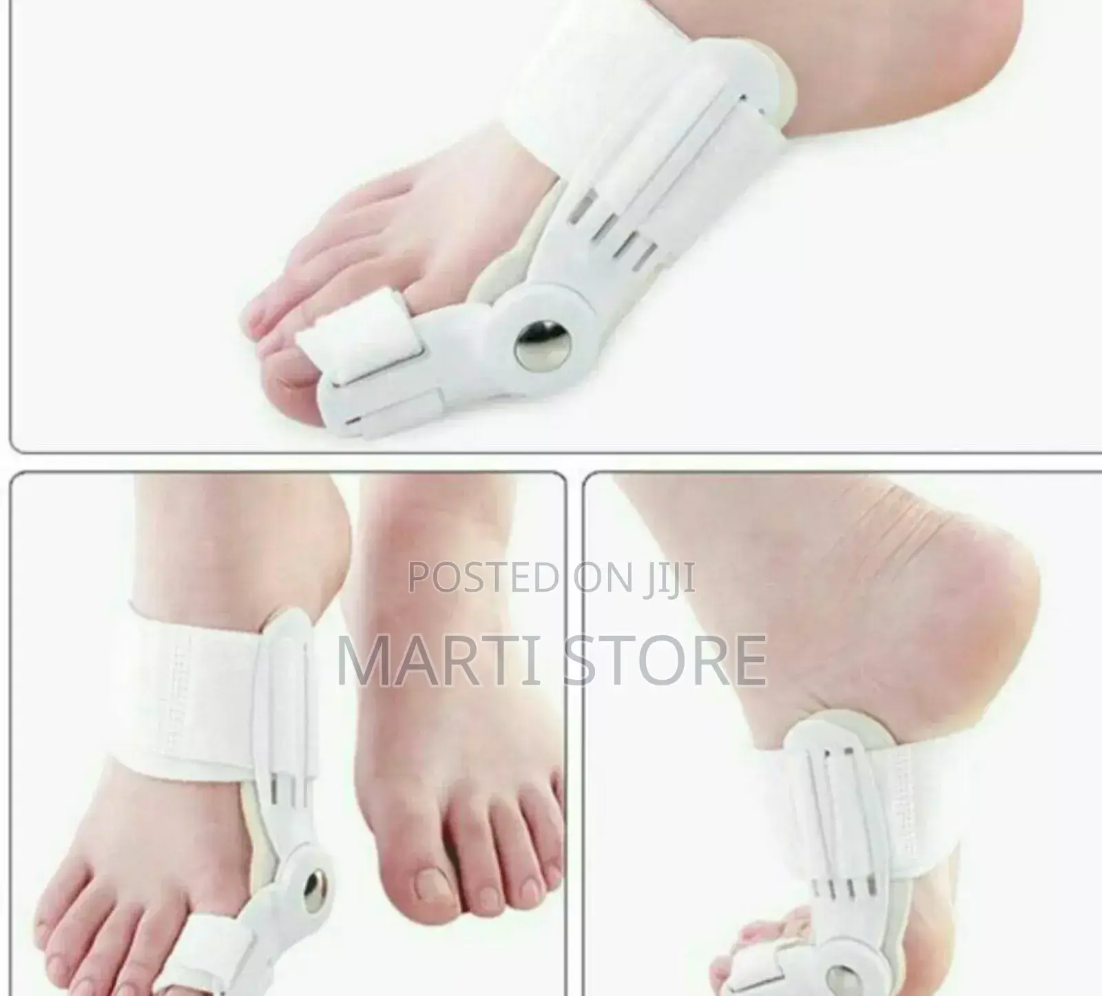 Orthopedic Beunion Toe Corrector