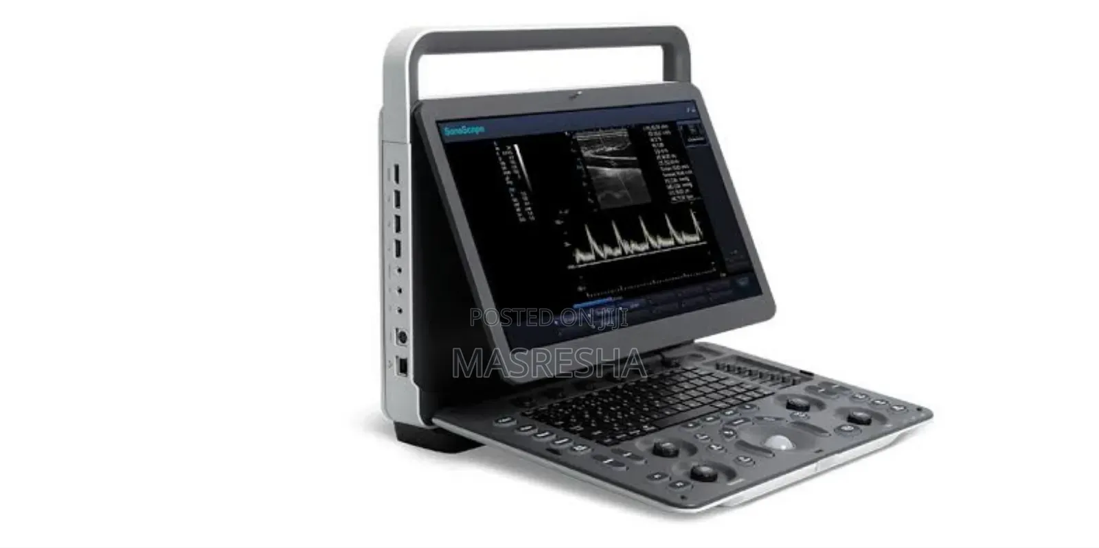 Ultrasound