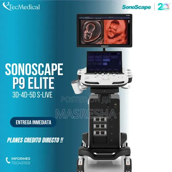 Color Doppler Ultrasound