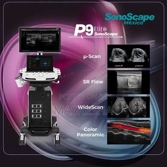 Color Doppler Ultrasound