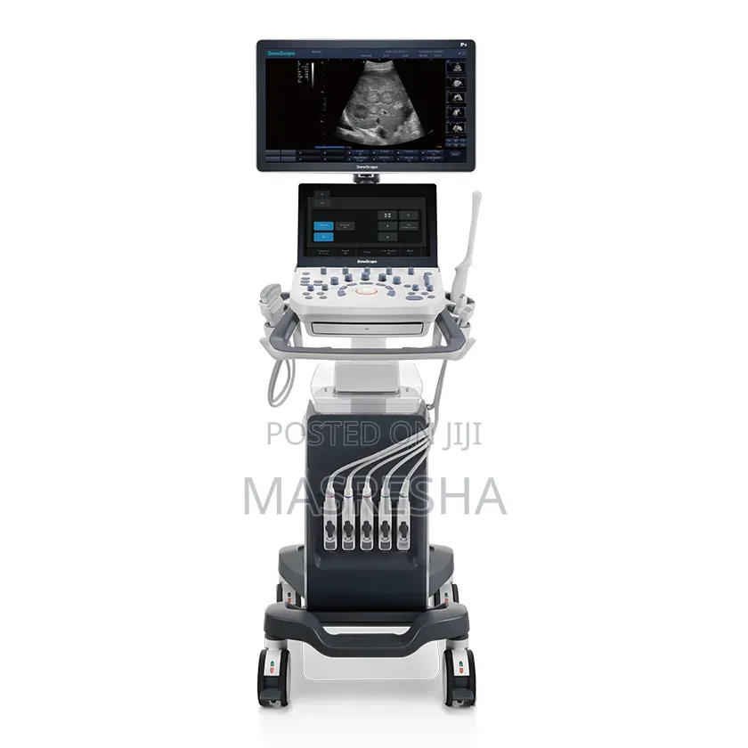 Color Doppler Ultrasound