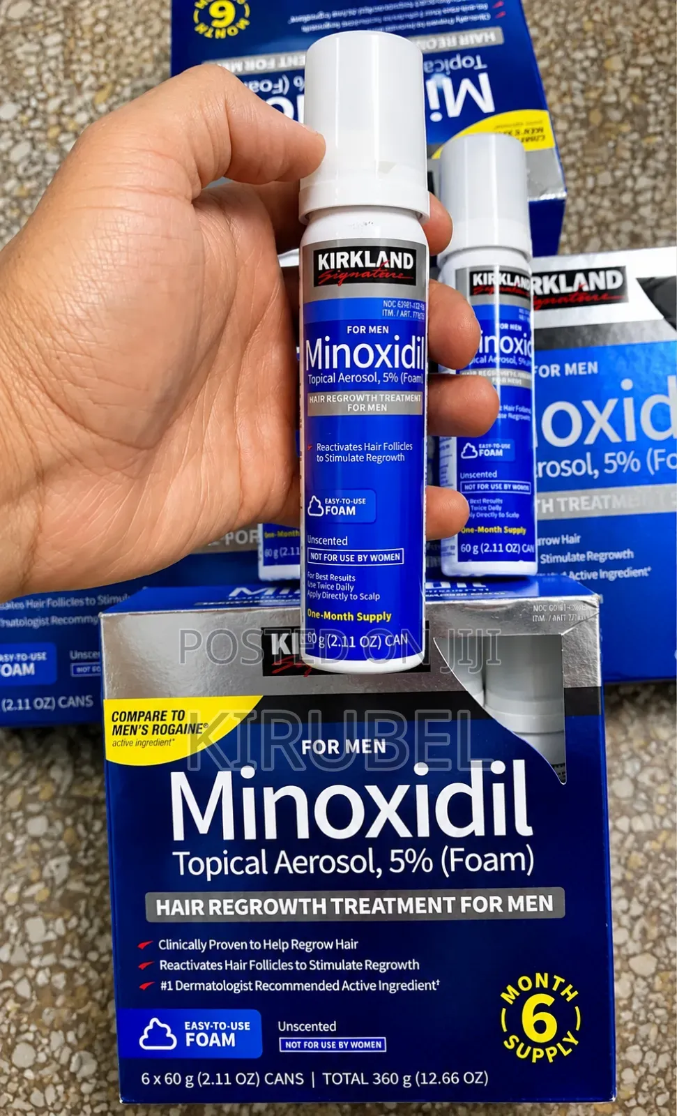 Foam Minoxidil