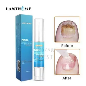 Lanthom Nail Repair