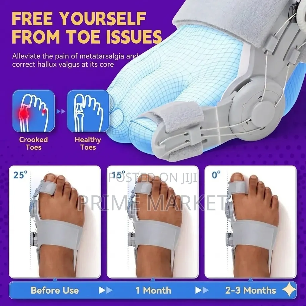 Adjustable Bunion Corrector Very Effective | Comfortable Pain Free