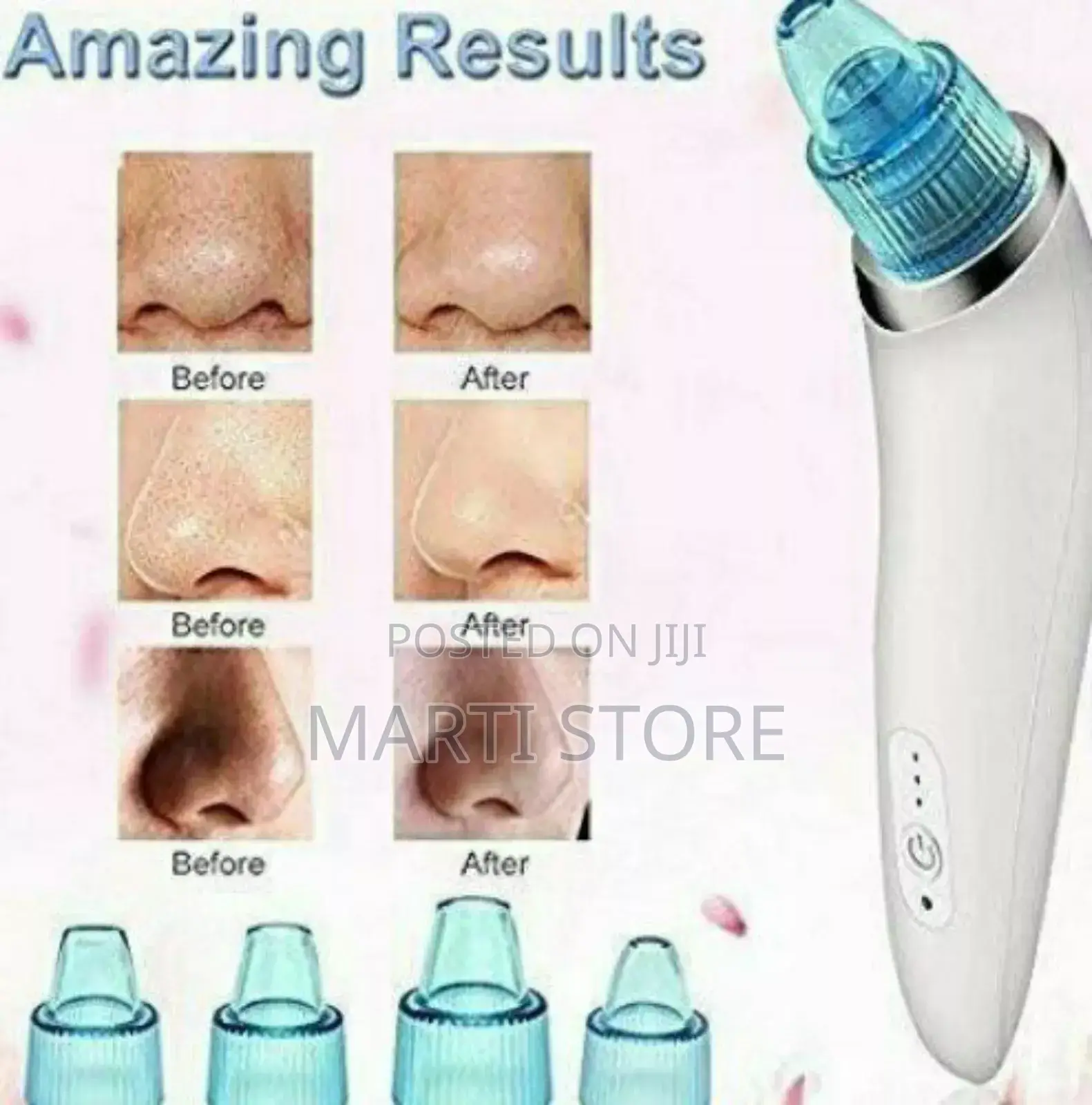 Vacuum Blackhade Remover