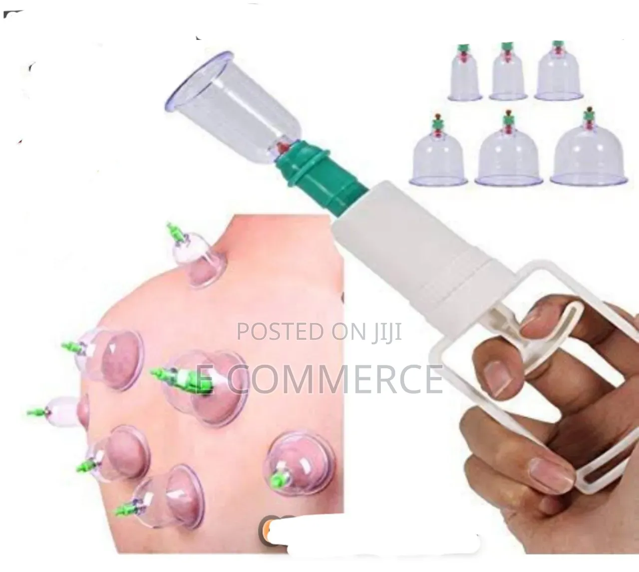 Traditional Cupping Terapy