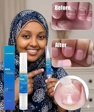 Lanthome Nail Repair