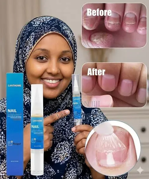 Lanthome Nail Repair