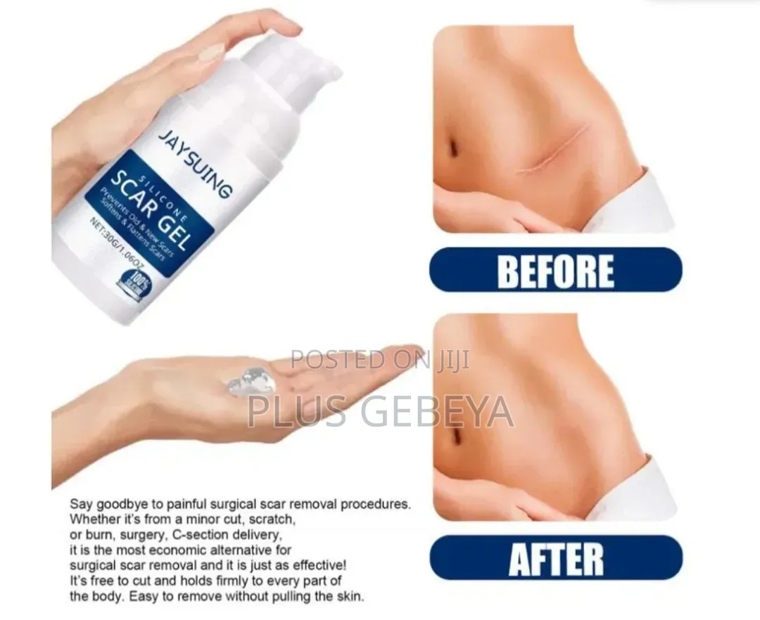 Silicone Scar Gel – Scar Care Gel (30g)