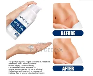 Silicone Scar Gel – Scar Care Gel (30g)