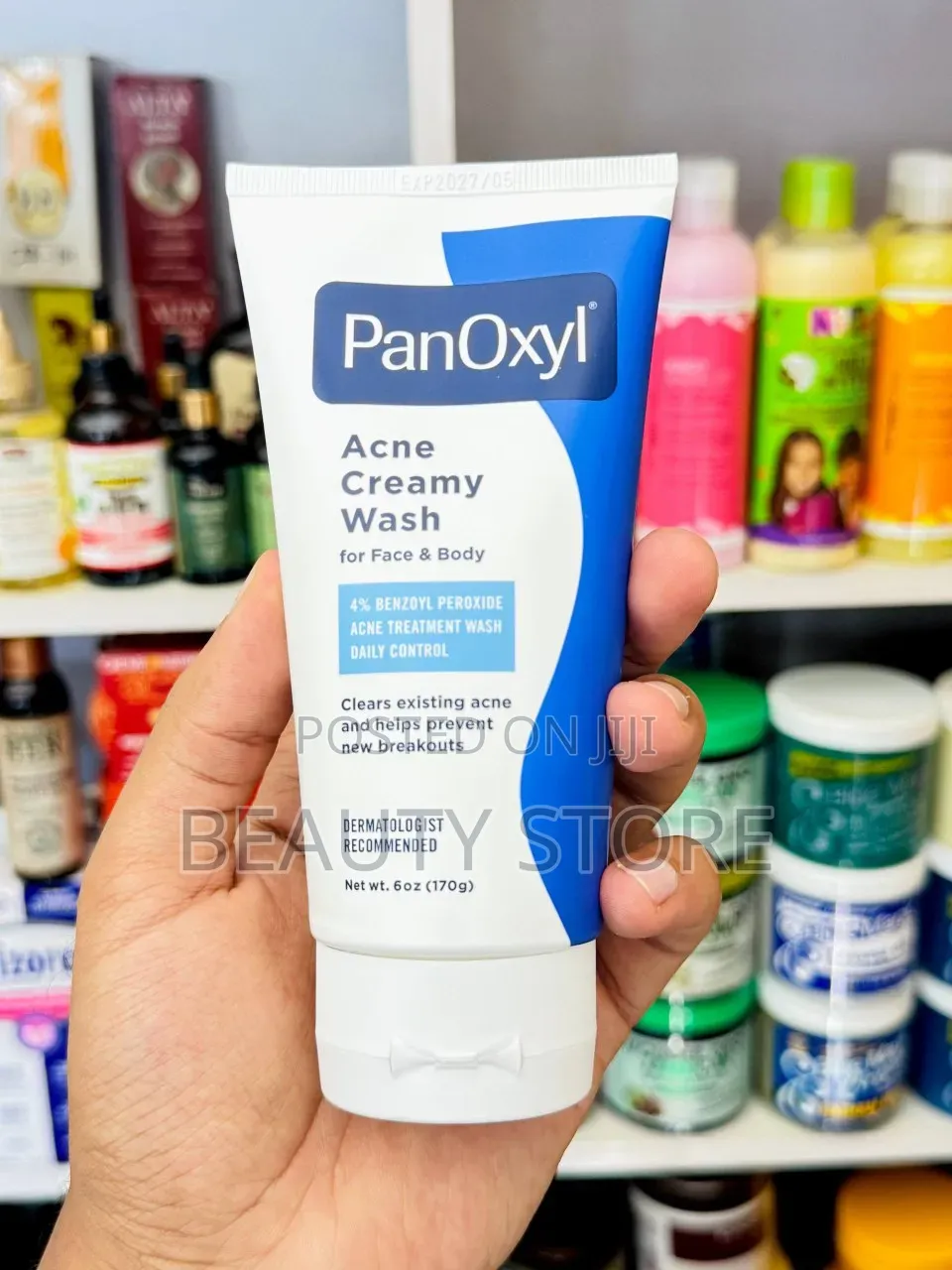 Panoxyl Acne Creamy Wash Contains 4% Benzoyl Peroxide