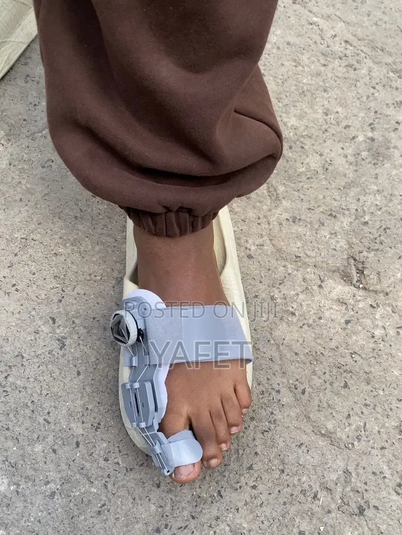 የተጣመመ አውራ ጣት ማስተካከያ