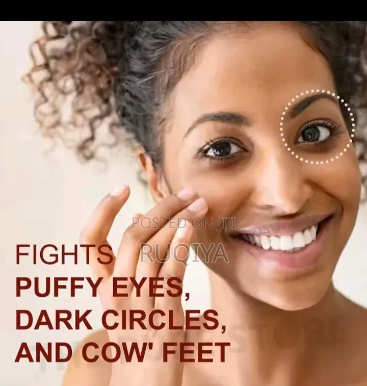 Eye Bags and Dark Circles Remember