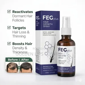 Feg Plus Hair Growth Spray 50ml – Anti Hair Fall Thickening Spray