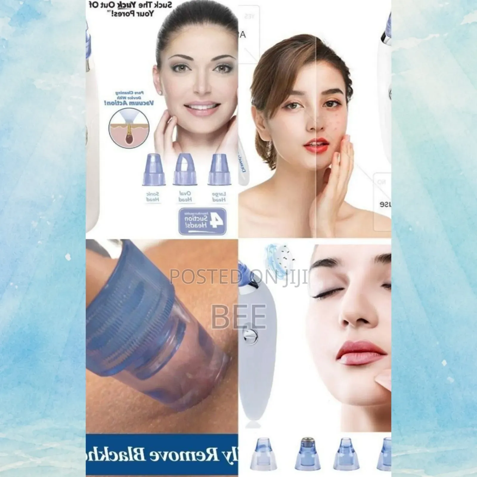  Dermasuction Facial Pore Cleaner