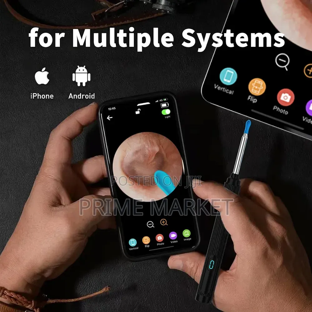 Ear Wax Cleaner Kit With Hd Camera Led Lights | Ios Android Phones