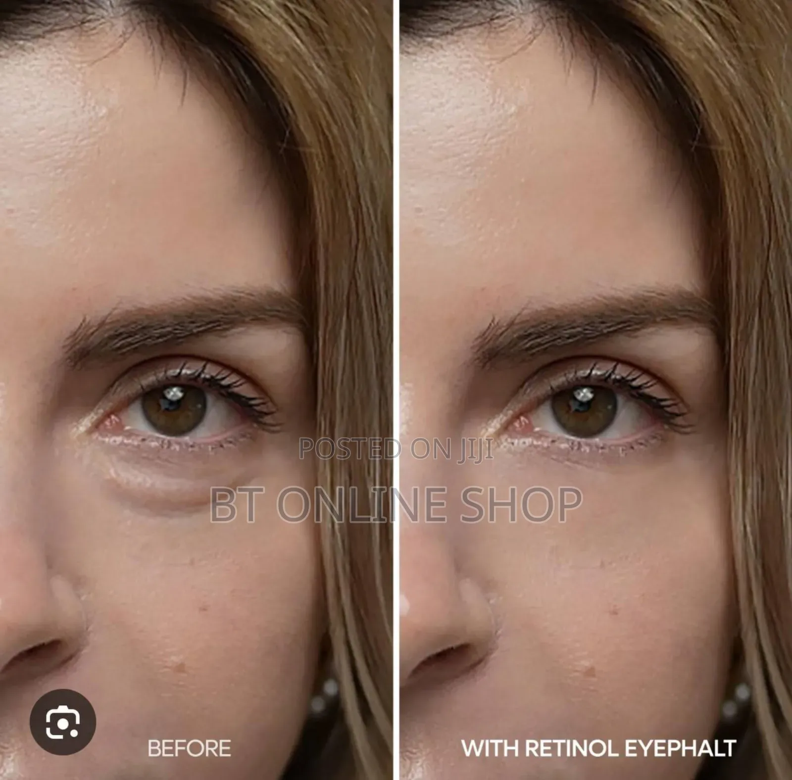 Dr.Melaxin Eyephalt Retinol Eyebag Cream